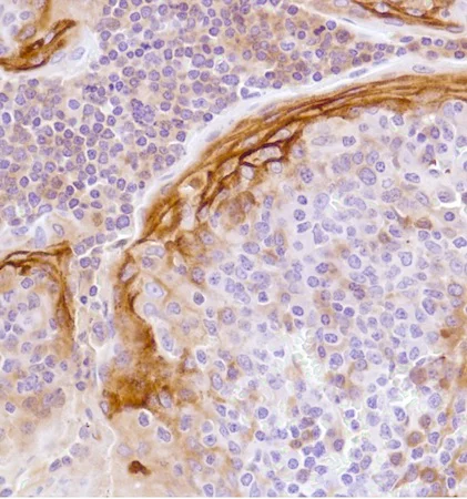 Immunohistochemistry (Formalin/PFA-fixed paraffin-embedded sections) - Anti-LYPD3 antibody [SP204] - BSA and Azide free (AB243924)
