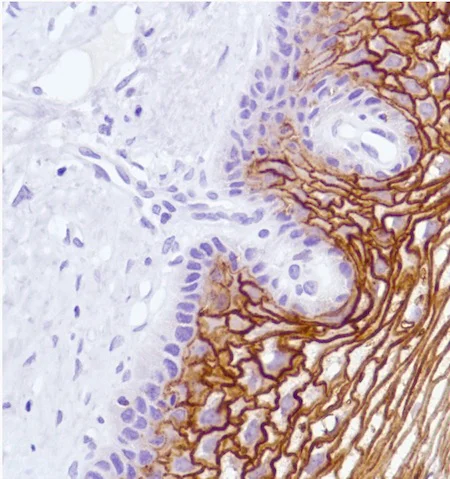 Immunohistochemistry (Formalin/PFA-fixed paraffin-embedded sections) - Anti-LYPD3 antibody [SP204] - BSA and Azide free (AB243924)
