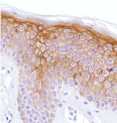 Immunohistochemistry (Formalin/PFA-fixed paraffin-embedded sections) - Anti-LYPD3 antibody [SP204] - BSA and Azide free (AB243924)
