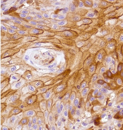 Immunohistochemistry (Formalin/PFA-fixed paraffin-embedded sections) - Anti-LYPD3 antibody [SP204] - BSA and Azide free (AB243924)