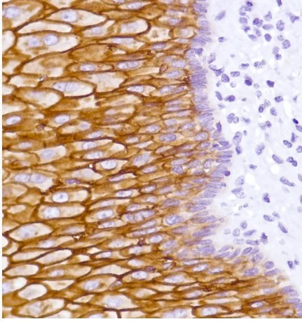 Immunohistochemistry (Formalin/PFA-fixed paraffin-embedded sections) - Anti-LYPD3 antibody [SP204] - BSA and Azide free (AB243924)