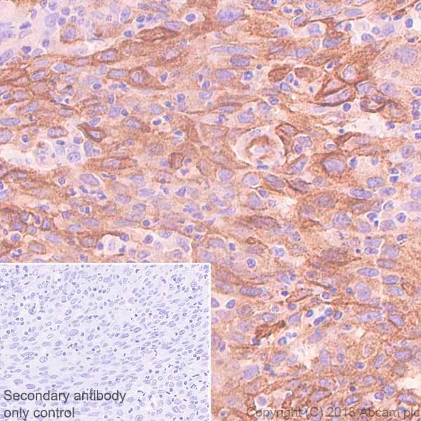 Immunohistochemistry (Formalin/PFA-fixed paraffin-embedded sections) - Anti-LYPD3 antibody [SP204] - BSA and Azide free (AB243924)