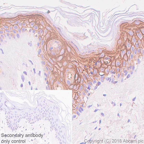 Immunohistochemistry (Formalin/PFA-fixed paraffin-embedded sections) - Anti-LYPD3 antibody [SP204] - BSA and Azide free (AB243924)