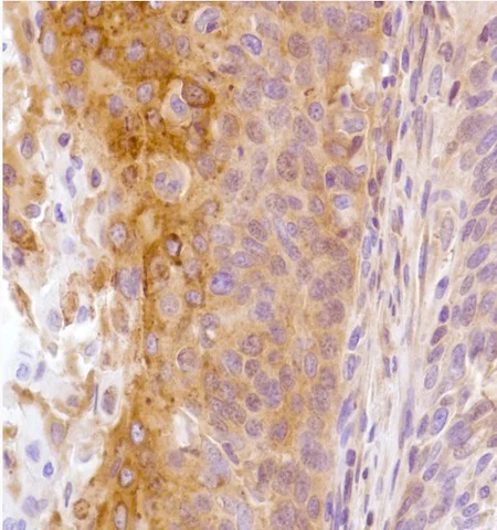 Immunohistochemistry (Formalin/PFA-fixed paraffin-embedded sections) - Anti-LYPD3 antibody [SP204] - BSA and Azide free (AB243924)