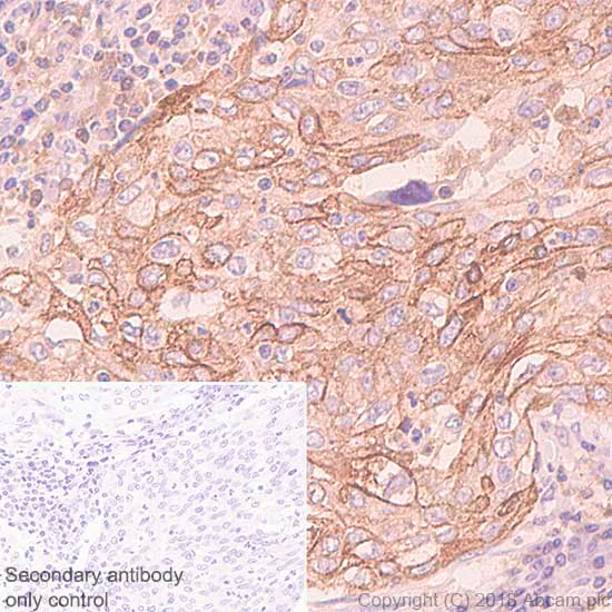Immunohistochemistry (Formalin/PFA-fixed paraffin-embedded sections) - Anti-LYPD3 antibody [SP208] (AB183357)