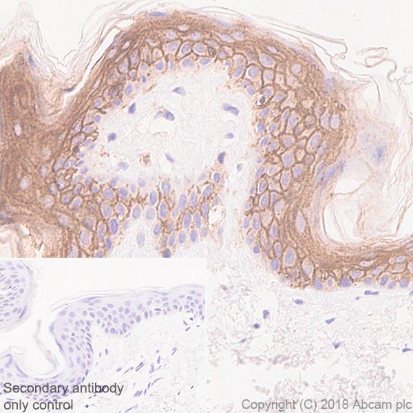 Immunohistochemistry (Formalin/PFA-fixed paraffin-embedded sections) - Anti-LYPD3 antibody [SP208] - BSA and Azide free (AB246349), expandable thumbnail