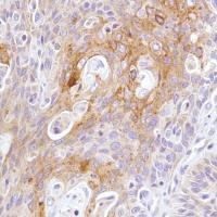 Immunohistochemistry (Formalin/PFA-fixed paraffin-embedded sections) - Anti-LYPD3 antibody [SP208] - BSA and Azide free (ab246349), expandable thumbnail