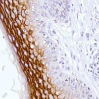 Immunohistochemistry (Formalin/PFA-fixed paraffin-embedded sections) - Anti-LYPD3 antibody [SP208] - BSA and Azide free (AB246349), expandable thumbnail