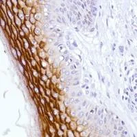 Immunohistochemistry (Formalin/PFA-fixed paraffin-embedded sections) - Anti-LYPD3 antibody [SP208] - BSA and Azide free (AB246349)