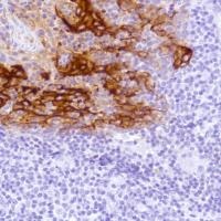 Immunohistochemistry (Formalin/PFA-fixed paraffin-embedded sections) - Anti-LYPD3 antibody [SP208] - BSA and Azide free (ab246349), expandable thumbnail