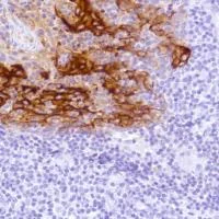 Immunohistochemistry (Formalin/PFA-fixed paraffin-embedded sections) - Anti-LYPD3 antibody [SP208] - BSA and Azide free (AB246349)