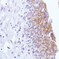 Immunohistochemistry (Formalin/PFA-fixed paraffin-embedded sections) - Anti-LYPD3 antibody [SP208] - BSA and Azide free (ab246349), expandable thumbnail