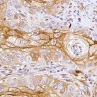 Immunohistochemistry (Formalin/PFA-fixed paraffin-embedded sections) - Anti-LYPD3 antibody [SP208] - BSA and Azide free (AB246349)