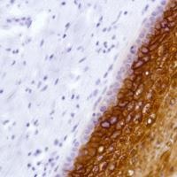 Immunohistochemistry (Formalin/PFA-fixed paraffin-embedded sections) - Anti-LYPD3 antibody [SP208] - BSA and Azide free (ab246349), expandable thumbnail
