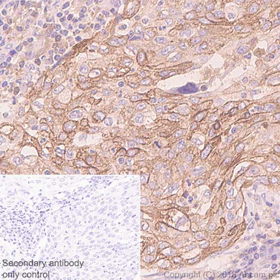 Immunohistochemistry (Formalin/PFA-fixed paraffin-embedded sections) - Anti-LYPD3 antibody [SP208] - BSA and Azide free (AB246349), expandable thumbnail