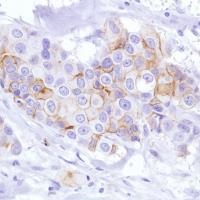 Immunohistochemistry (Formalin/PFA-fixed paraffin-embedded sections) - Anti-LYPD3 antibody [SP208] - BSA and Azide free (ab246349), expandable thumbnail