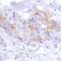 Immunohistochemistry (Formalin/PFA-fixed paraffin-embedded sections) - Anti-LYPD3 antibody [SP208] - BSA and Azide free (AB246349)