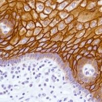 Immunohistochemistry (Formalin/PFA-fixed paraffin-embedded sections) - Anti-LYPD3 antibody [SP208] - BSA and Azide free (AB246349), expandable thumbnail