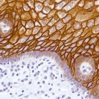 Immunohistochemistry (Formalin/PFA-fixed paraffin-embedded sections) - Anti-LYPD3 antibody [SP208] - BSA and Azide free (AB246349)