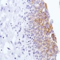 Immunohistochemistry (Formalin/PFA-fixed paraffin-embedded sections) - Anti-LYPD3 antibody [SP208], prediluted (AB228289)