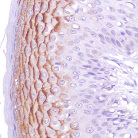 Immunohistochemistry (Formalin/PFA-fixed paraffin-embedded sections) - Anti-LYPD3 antibody [SP250] - N-terminal (AB192845)