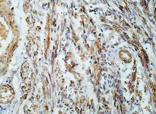 Immunohistochemistry (Formalin/PFA-fixed paraffin-embedded sections) - Anti-LYPD6B antibody (AB201163)
