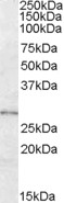 Western blot - Anti-LYPLAL1 antibody (AB77640)