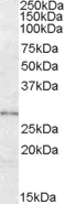 Western blot - Anti-LYPLAL1 antibody (AB77640)