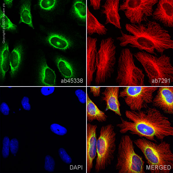 Immunocytochemistry/ Immunofluorescence - Anti-LYRIC/AEG1 antibody (AB45338)