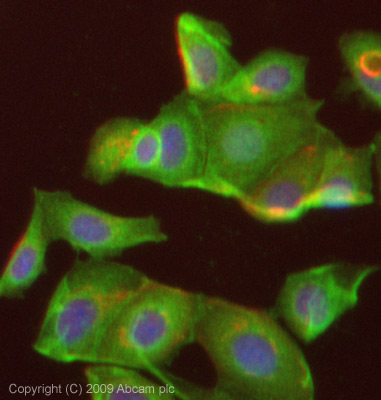 Immunocytochemistry/ Immunofluorescence - Anti-LYRIC/AEG1 antibody (AB45338)