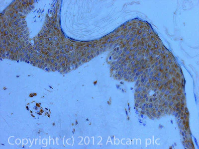 Immunohistochemistry (Formalin/PFA-fixed paraffin-embedded sections) - Anti-LYRIC/AEG1 antibody (AB45338)