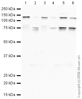 Western blot - Anti-LYRIC/AEG1 antibody (AB45338)