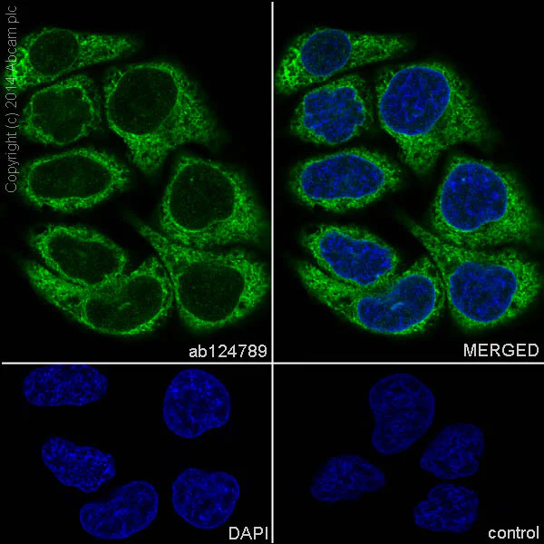 Immunocytochemistry/ Immunofluorescence - Anti-LYRIC/AEG1 antibody [EP4445] (AB124789)