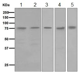 Western blot - Anti-LYRIC/AEG1 antibody [EP4445] (AB124789)