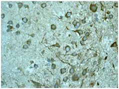 Immunohistochemistry (Formalin/PFA-fixed paraffin-embedded sections) - Anti-LYRIC/AEG1 antibody [EP4445] - BSA and Azide free (AB239999)