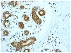 Immunohistochemistry (Formalin/PFA-fixed paraffin-embedded sections) - Anti-LYRIC/AEG1 antibody [EP4445] - BSA and Azide free (AB239999)