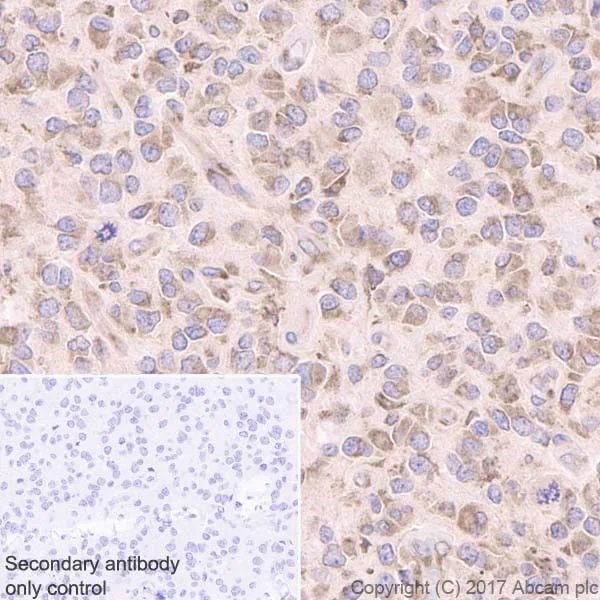 Immunohistochemistry (Formalin/PFA-fixed paraffin-embedded sections) - Anti-LYRIC/AEG1 antibody [EPR20797] (AB227981)
