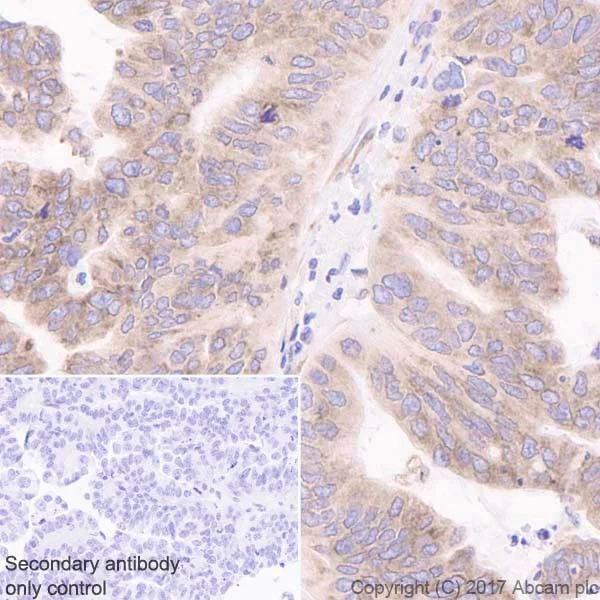 Immunohistochemistry (Formalin/PFA-fixed paraffin-embedded sections) - Anti-LYRIC/AEG1 antibody [EPR20797] (AB227981)