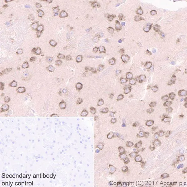 Immunohistochemistry (Formalin/PFA-fixed paraffin-embedded sections) - Anti-LYRIC/AEG1 antibody [EPR20797] (AB227981)