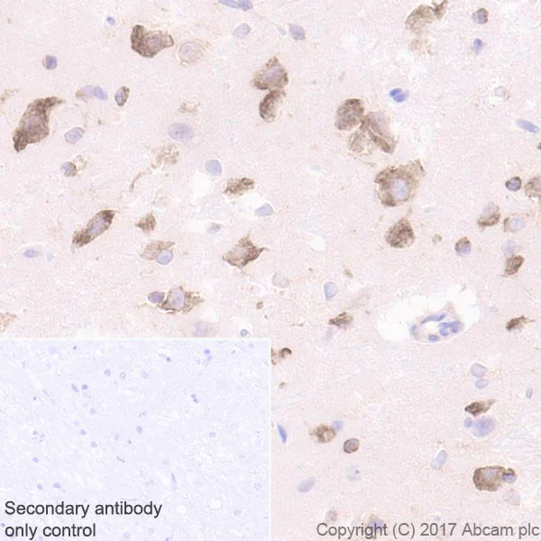 Immunohistochemistry (Formalin/PFA-fixed paraffin-embedded sections) - Anti-LYRIC/AEG1 antibody [EPR20797] (AB227981)
