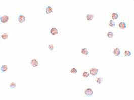 Immunocytochemistry - Anti-LYRM2 antibody (AB106686), expandable thumbnail