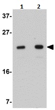 Western blot - Anti-LYRM2 antibody (AB106686), expandable thumbnail