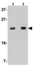 Western blot - Anti-LYRM2 antibody (AB106686)