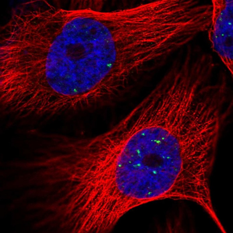 Immunocytochemistry/ Immunofluorescence - Anti-LYRM4 antibody (AB253001)