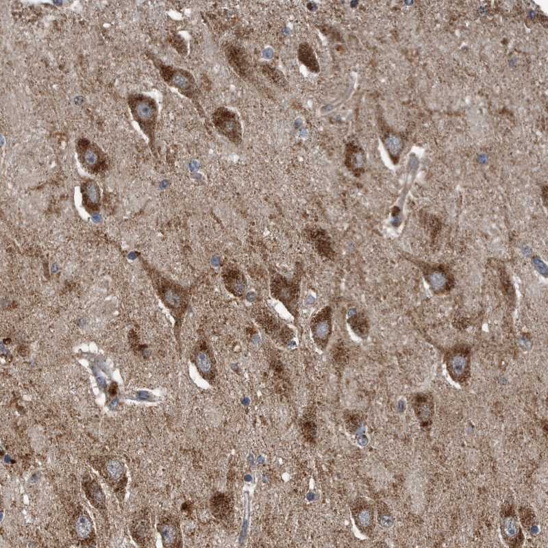 Immunohistochemistry (Formalin/PFA-fixed paraffin-embedded sections) - Anti-LYRM4 antibody (AB253001)
