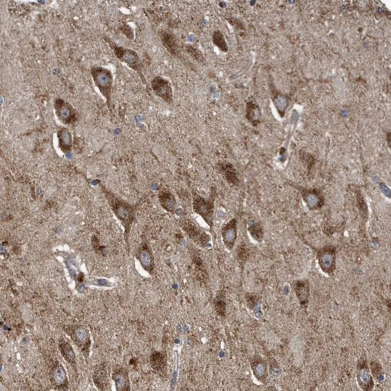 Immunohistochemistry (Formalin/PFA-fixed paraffin-embedded sections) - Anti-LYRM4 antibody (AB253001)