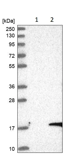 Western blot - Anti-LYRM4 antibody (AB253001)