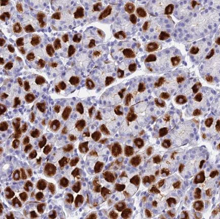 Immunohistochemistry (Formalin/PFA-fixed paraffin-embedded sections) - Anti-LYRM5 antibody (AB126379)
