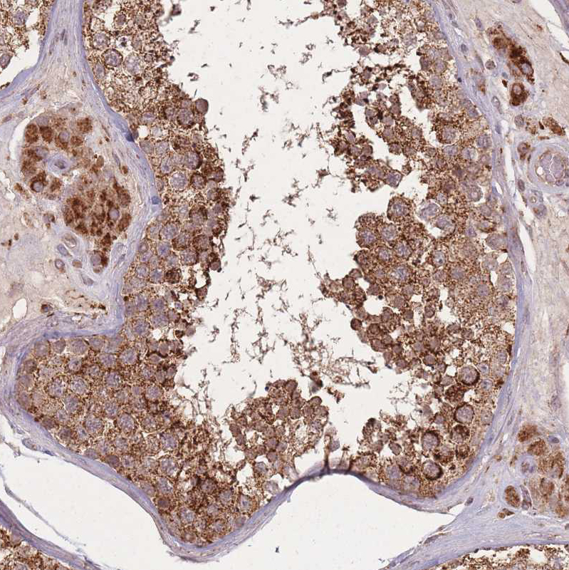 Immunohistochemistry (Formalin/PFA-fixed paraffin-embedded sections) - Anti-LYRM7 antibody (AB151089)