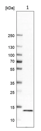 Western blot - Anti-LYRM7 antibody (AB151089)